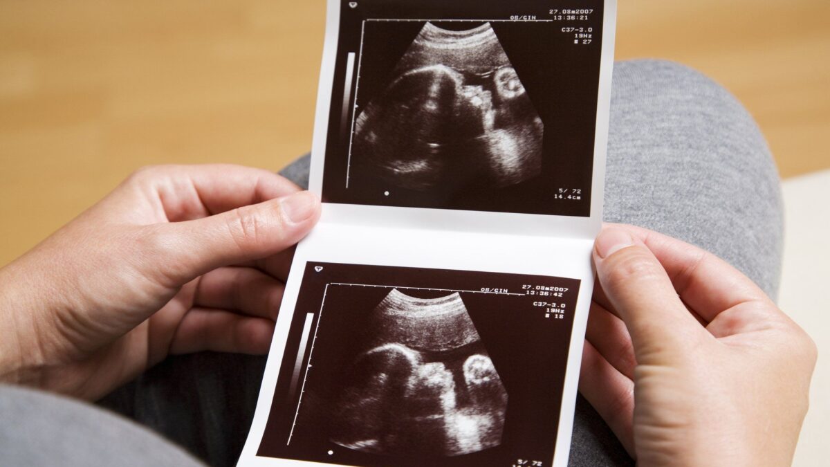 Solo in una società ipocrita e perversa sopprimere un bimbo non è un omicidio