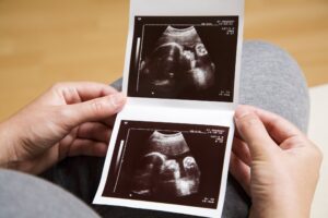 Solo in una società ipocrita e perversa sopprimere un bimbo non è un omicidio
