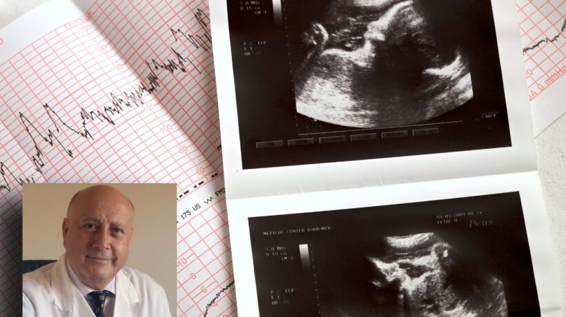 «Con la sindrome di Down l’aborto è regola»