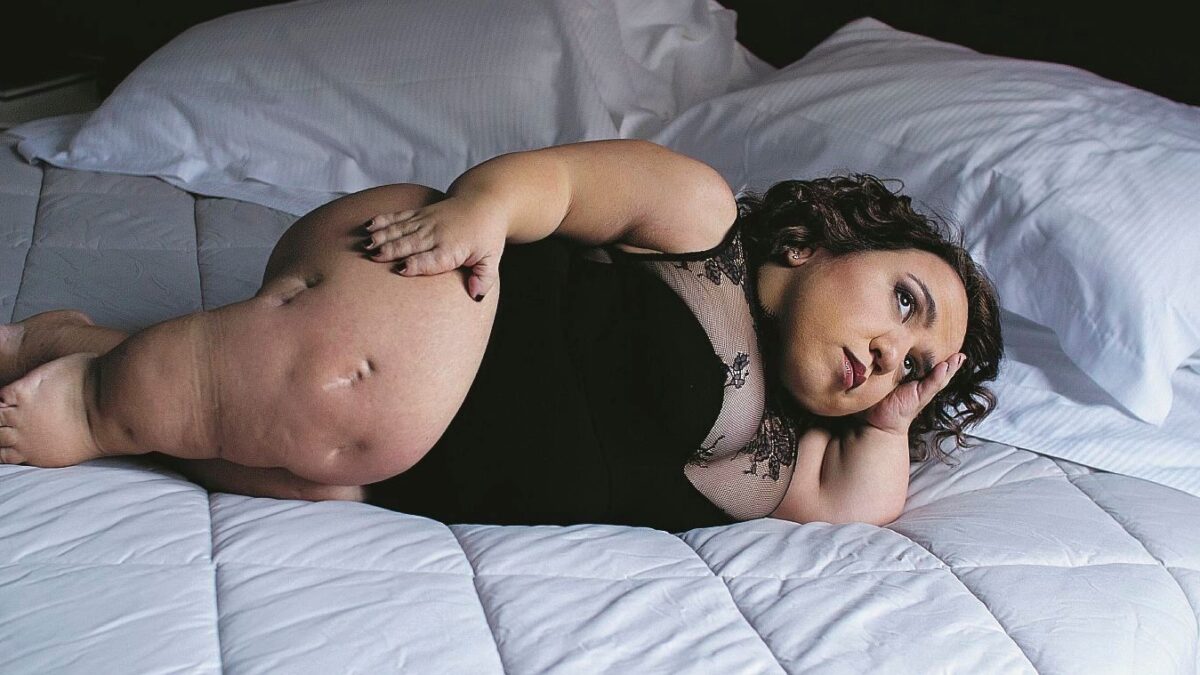 «La sedia a rotelle non toglie la femminilità»