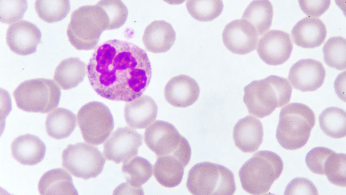 Sarà rimborsata la super cura antitumore