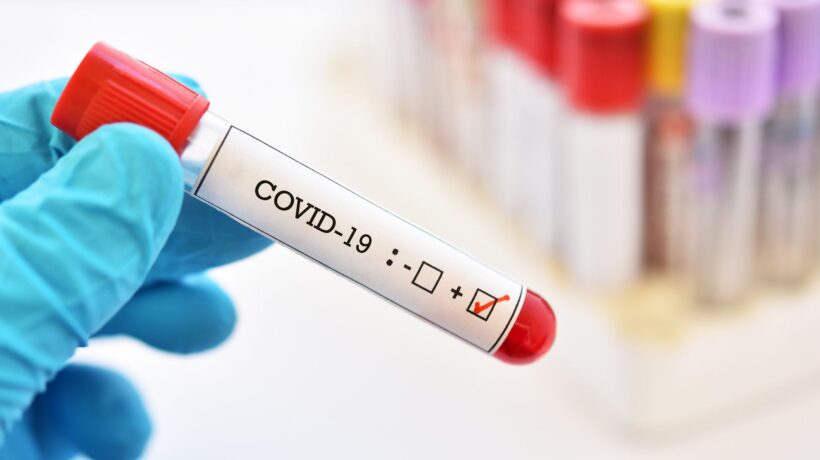 Ormai tutti gli esperti concordano: virus portato in Italia dai tedeschi