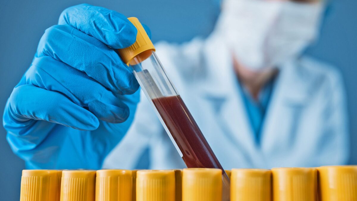 Lo screening del sangue per poter ripartire