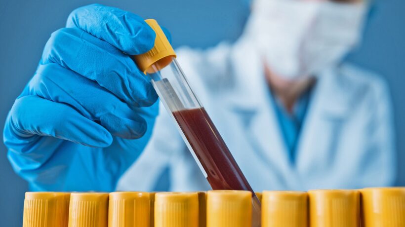 Lo screening del sangue per poter ripartire