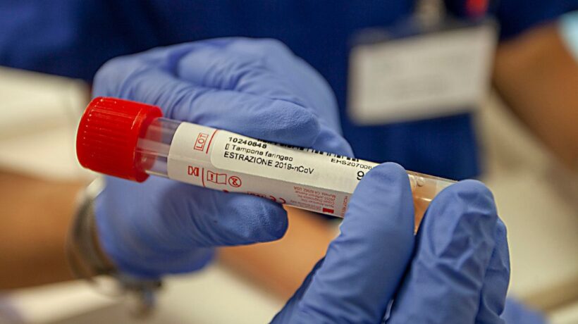 Tamponi gratuiti dai medici di base. «Ma i test rapidi non sono arrivati»