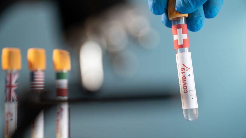 La Svizzera sta peggio, ma è immune all’isteria