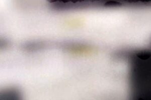 Anche l’influenza intasava le rianimazioni, eppure nessuno s’è posto il problema
