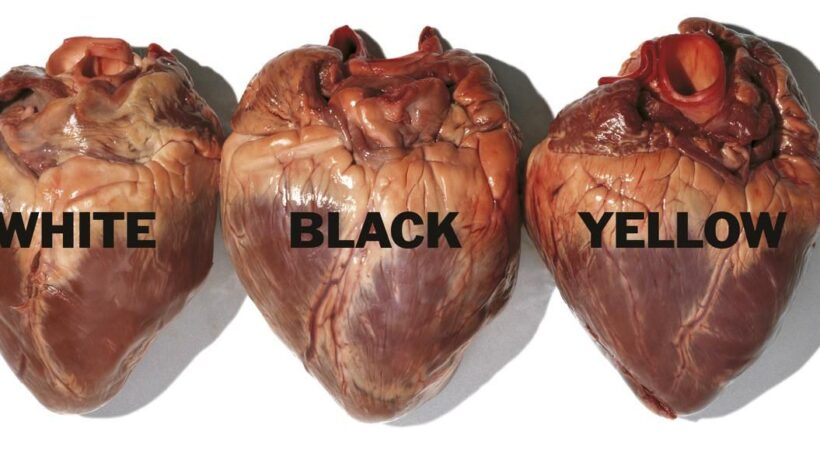 Oliviero Toscani in mostra a Palazzo Reale di Milano