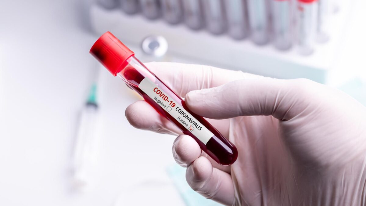 Studio choc: alterazioni nel sangue dei vaccinati
