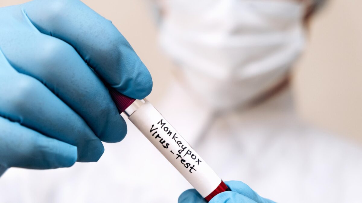 Il sesso gay è un detonatore di pericoli per la salute. E non c’è solo il monkeypox