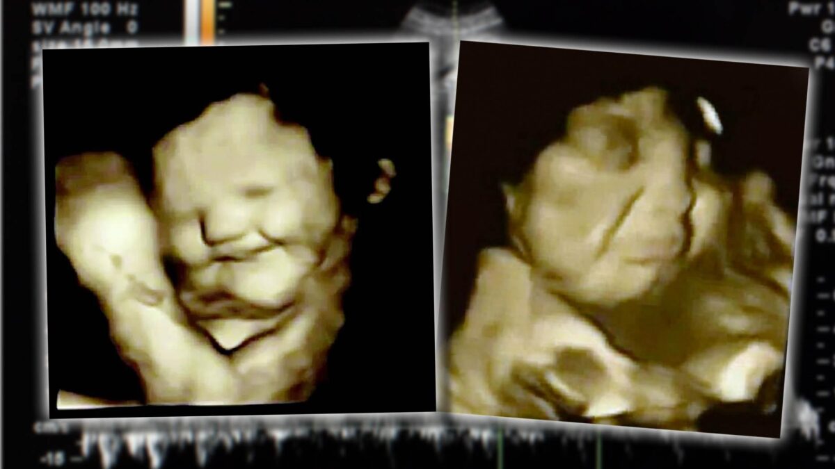 Il feto sorride se assaggia la carota.  Ma per tutti «l’aborto non si tocca»