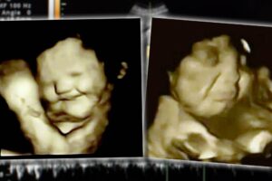 Il feto sorride se assaggia la carota.  Ma per tutti «l’aborto non si tocca»