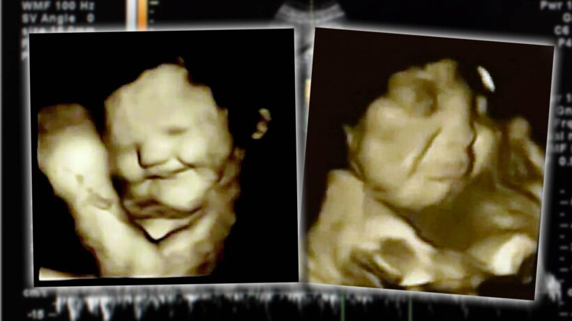Il feto sorride se assaggia la carota.  Ma per tutti «l’aborto non si tocca»