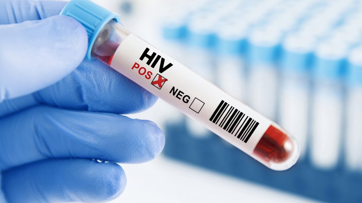 Dopo la pandemia crescono le diagnosi di Hiv