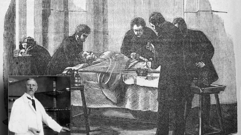 1896: cronaca della prima operazione chirurgica a cuore aperto