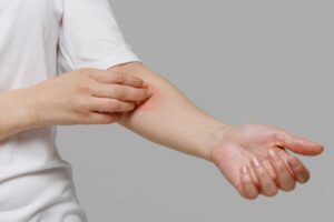 Dai cibi all’acqua, il nichel è ovunque. Ecco quando potrebbe farci male