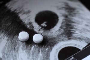 Vogliono che l’aborto sia un diritto per criminalizzare chi si oppone